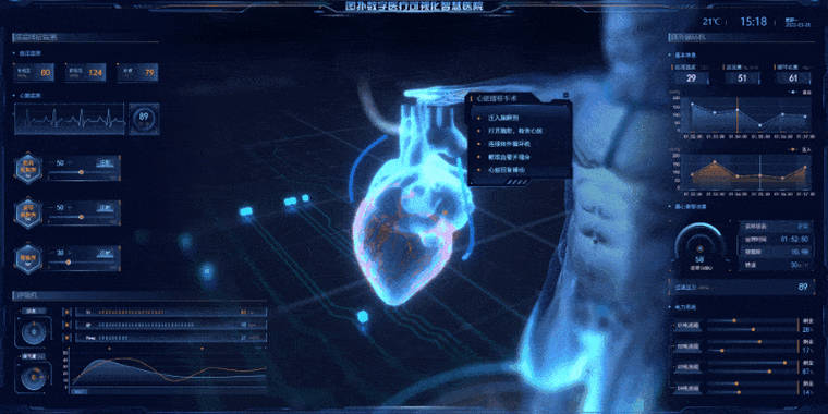 0024858d26ee41329b5ffe0402b774a0.gif