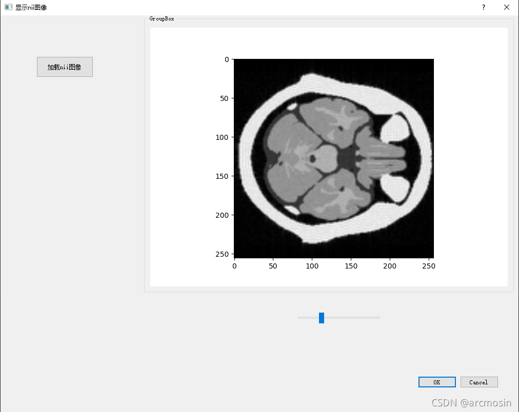 Pyqt5+matplotlib+NIFTI(nii)图像显示(1)_网页展示nii图像可拖动-CSDN博客