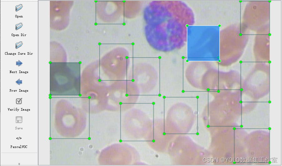 YOLO目标检测——红细胞数据集【(含对应voc、coco和yolo三种格式标签】