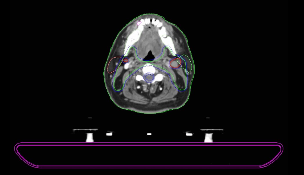 Vtk Ct VTK加载DICOM图像并加载RTSTRUCT文件的ContourData_vtk dicom-CSDN博客