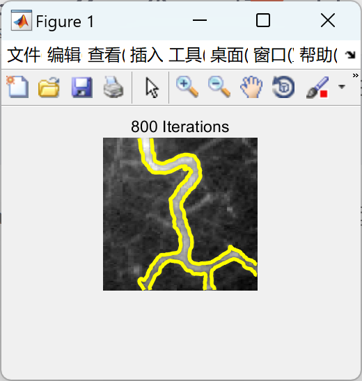 【局部活动轮廓】使用水平集方法实现局部活动轮廓方法研究（Matlab代码实现）