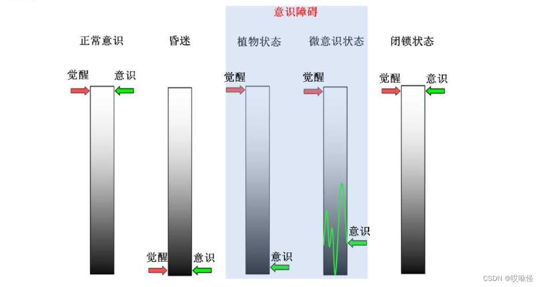 不同意识水平下的脑障碍