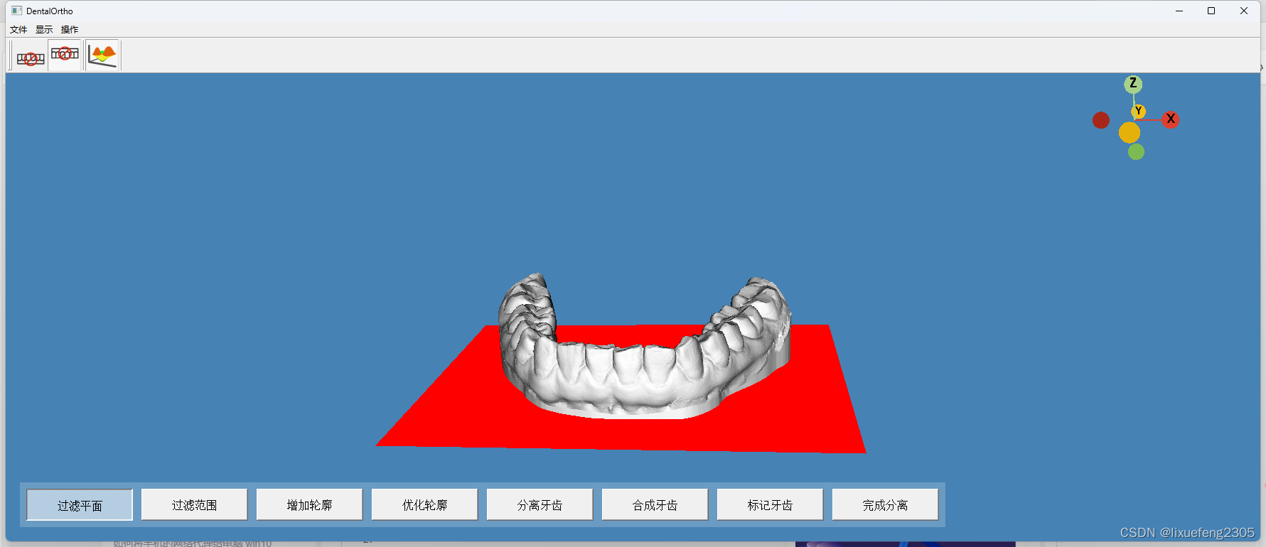 基于VTK的牙齿三维模型分割软件(邮箱:3484918541@qq.com)