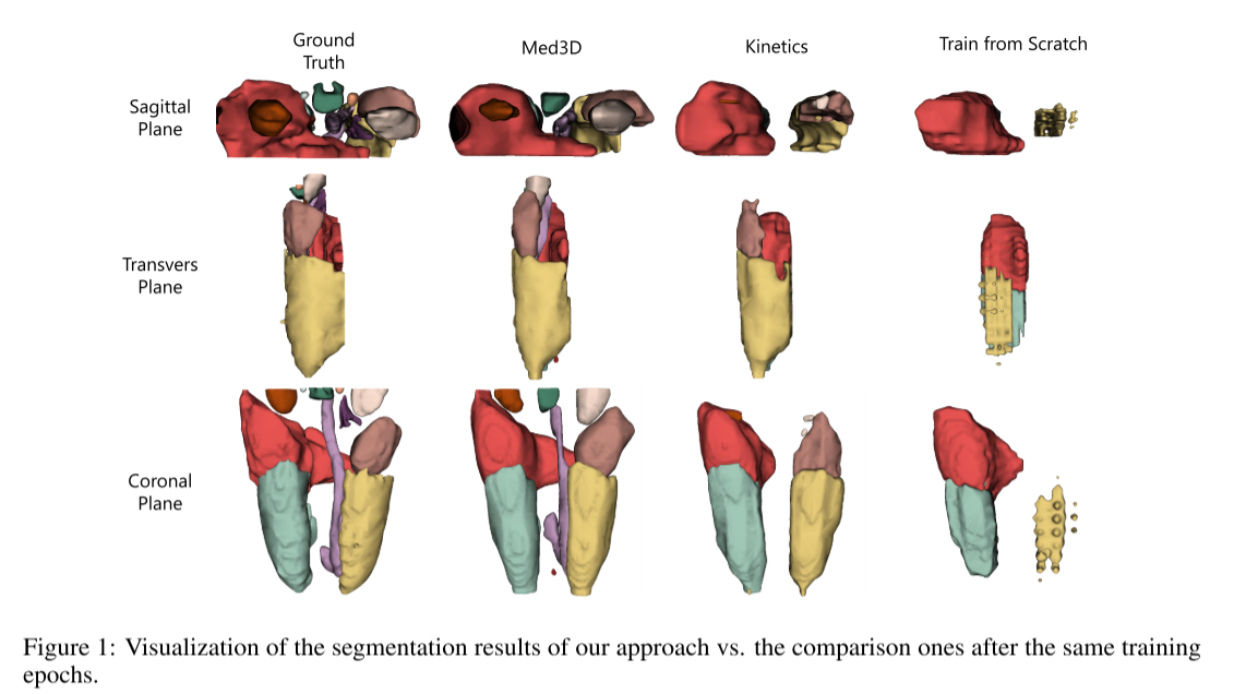 论文总结：MED3D: TRANSFER LEARNING FOR 3D MEDICAL IMAGEANALYSIS_medicalnet ...