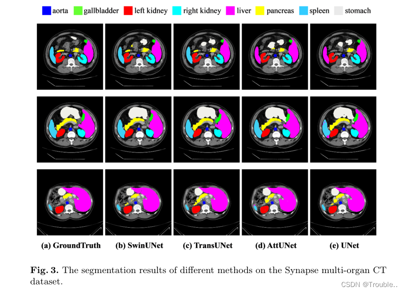 [The external link image transfer failed. The source site may have an anti-leeching mechanism. It is recommended to save the image and upload it directly (img-0yaDP9fH-1673942843104) (Swin-Unet Unet-like Pure Transformer for Medical Image Segmentation.assets/image-20230117160030129. png)]