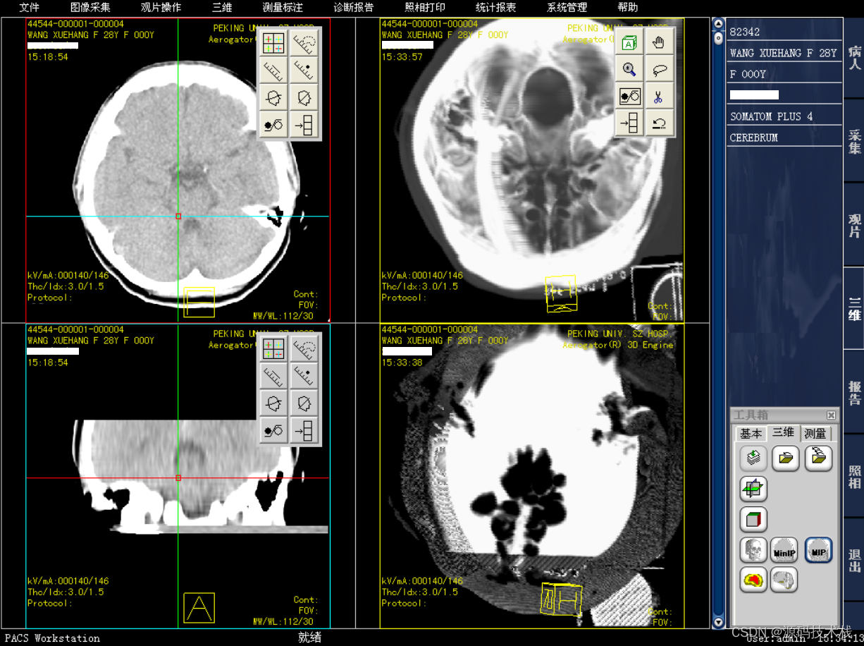 基于C++开发的医院医学影像PACS 可二次开发，三维重建