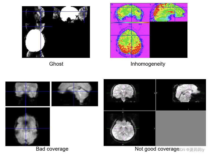 静息态功能磁共振成像(rs-fMRI)原理与数据分析学习笔记（4-5）：The R-fMRI Maps Project And Animal ...