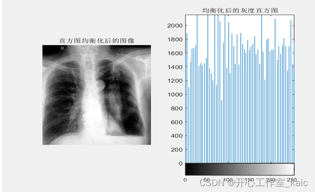 医学图像增强系统的设计_kaic