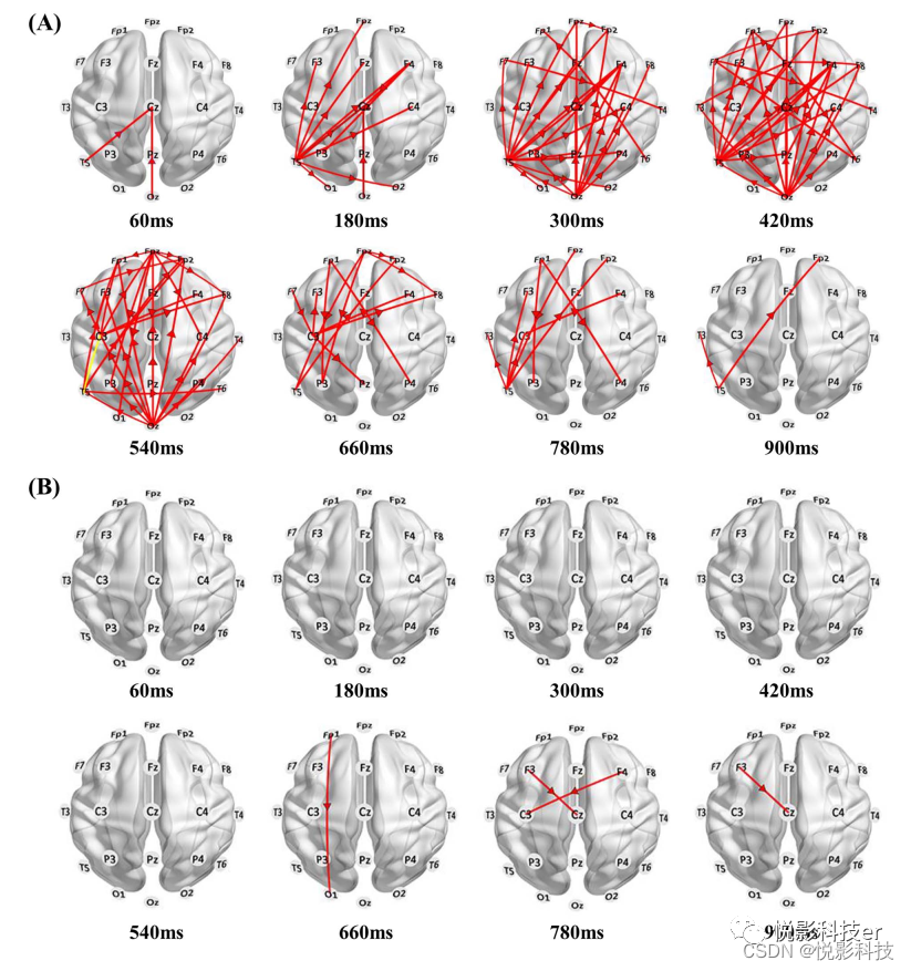 Cerebral Cortex：调节γ振荡可以促进大脑连接性而改善认知障碍