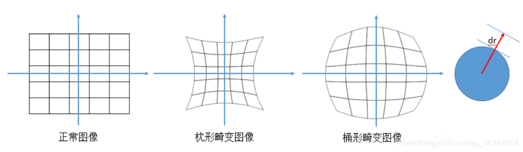 徑向畸變