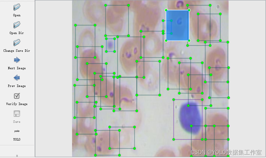 YOLO目标检测——红白细胞血小板数据集【含对应voc、coco和yolo三种格式标签】