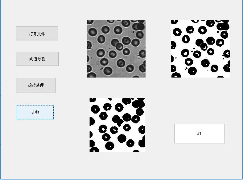 【MATLAB】一个简单的程序实现细胞计数