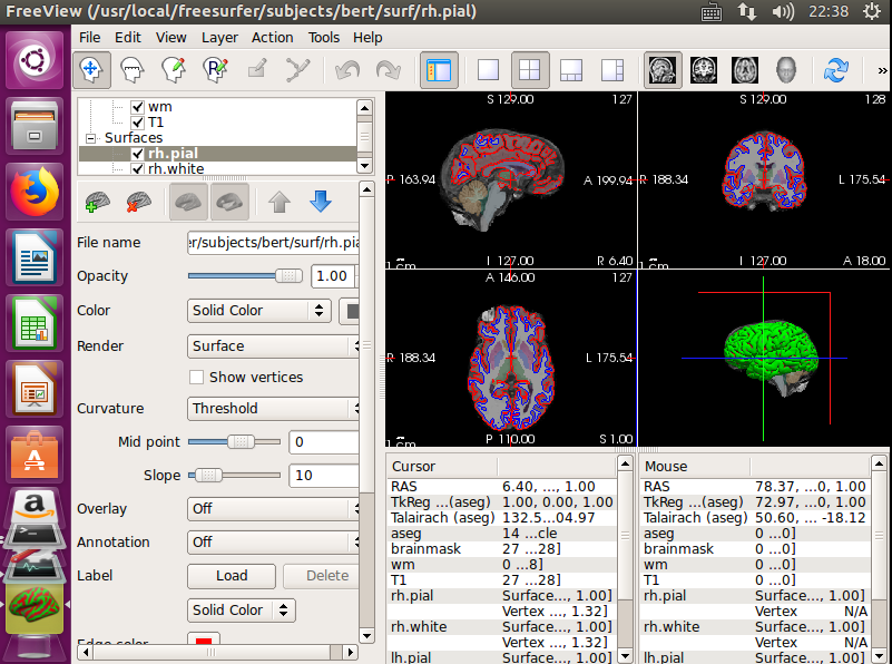 ubuntu and freesurfer 安装手册_freesurfer安装教程-CSDN博客