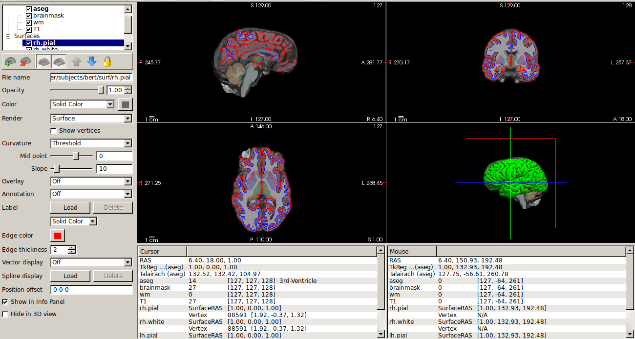 Ubuntu 18.04安装FreeSurfer软件_ubuntu如何调出freesufer-CSDN博客