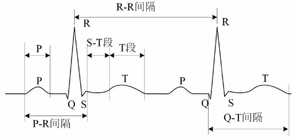 心电图