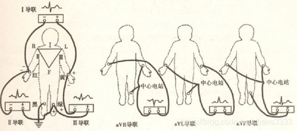 在這裡插入圖片描述