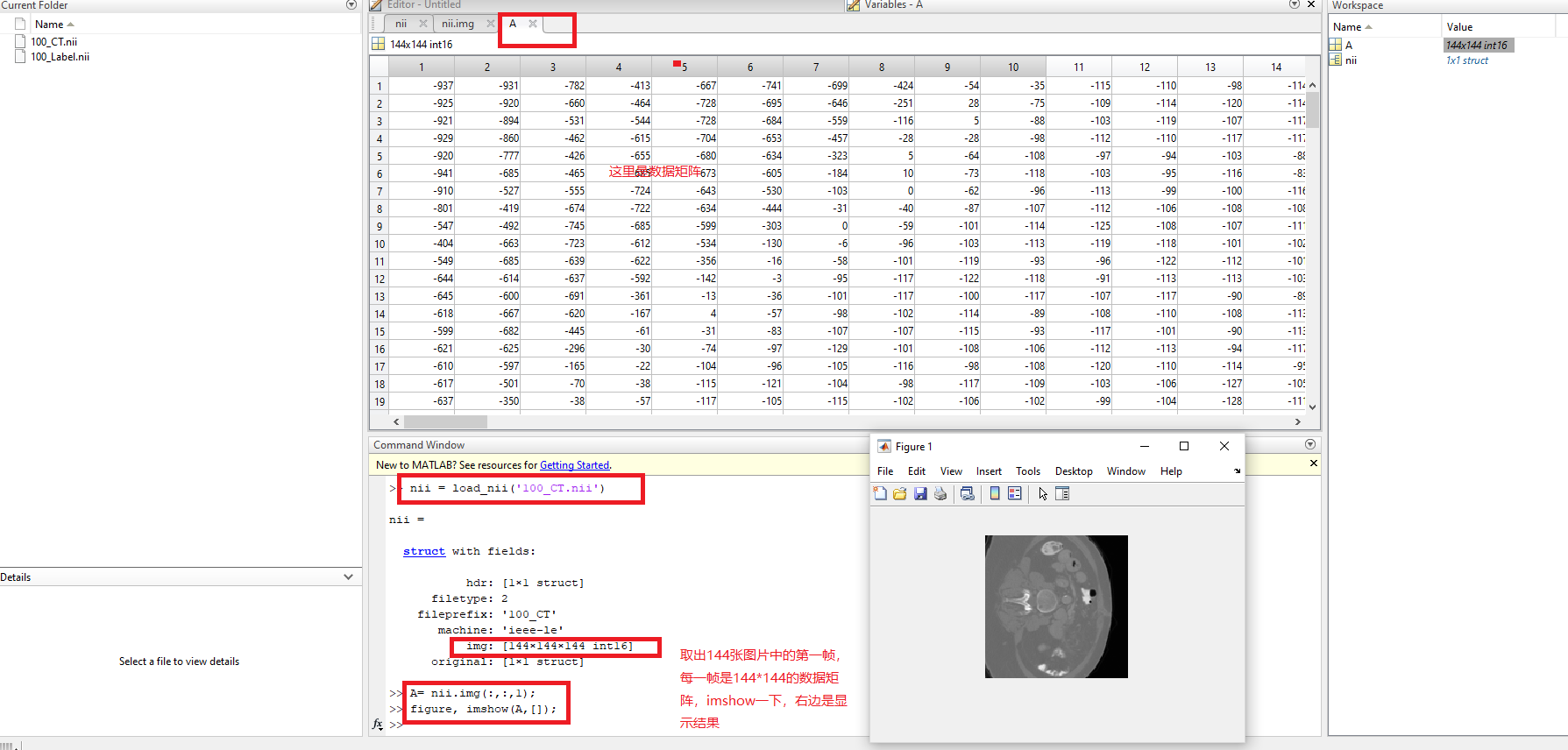 matlab 2018b查看nii图像