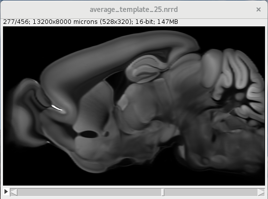 Allen brain average template 25um