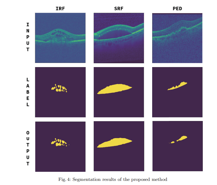 【医疗图像分割】Deep neural networks for the detection and segmentation of the ...