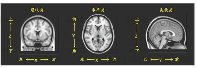 MRI标准空间坐标