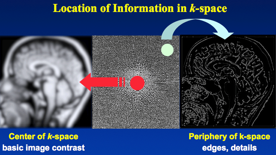 mri-mri-space-lxy-alex-csdn