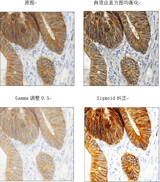 Skimage图像处理教程3）曝光度调整