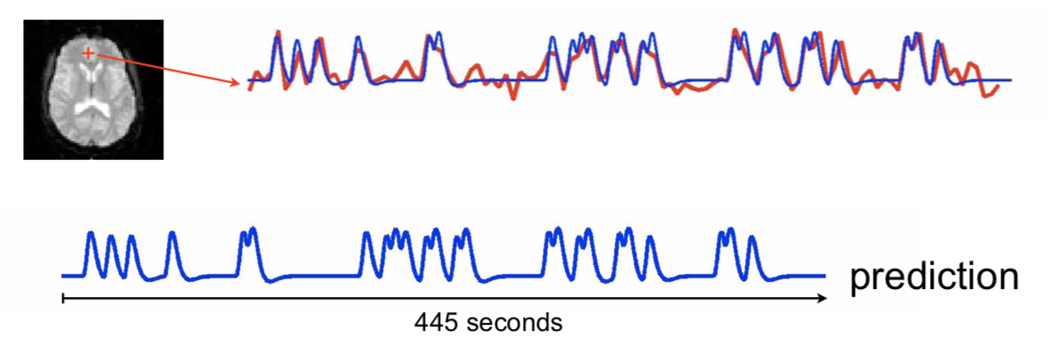 FSL 功能磁共振影像分析： single-session_核磁两个功能session_lxy_Alex的博客-CSDN博客