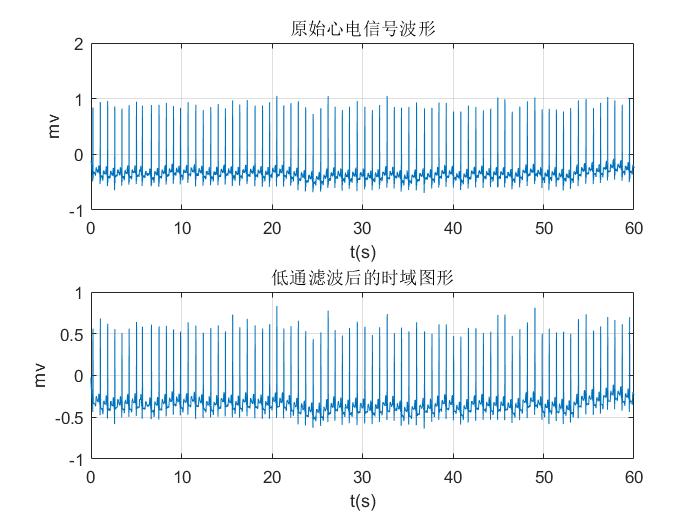 基于MATLAB实现ECG心电信号处理