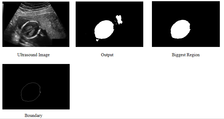 Fetal head circumference automatic measurement-ultrasound image project ...