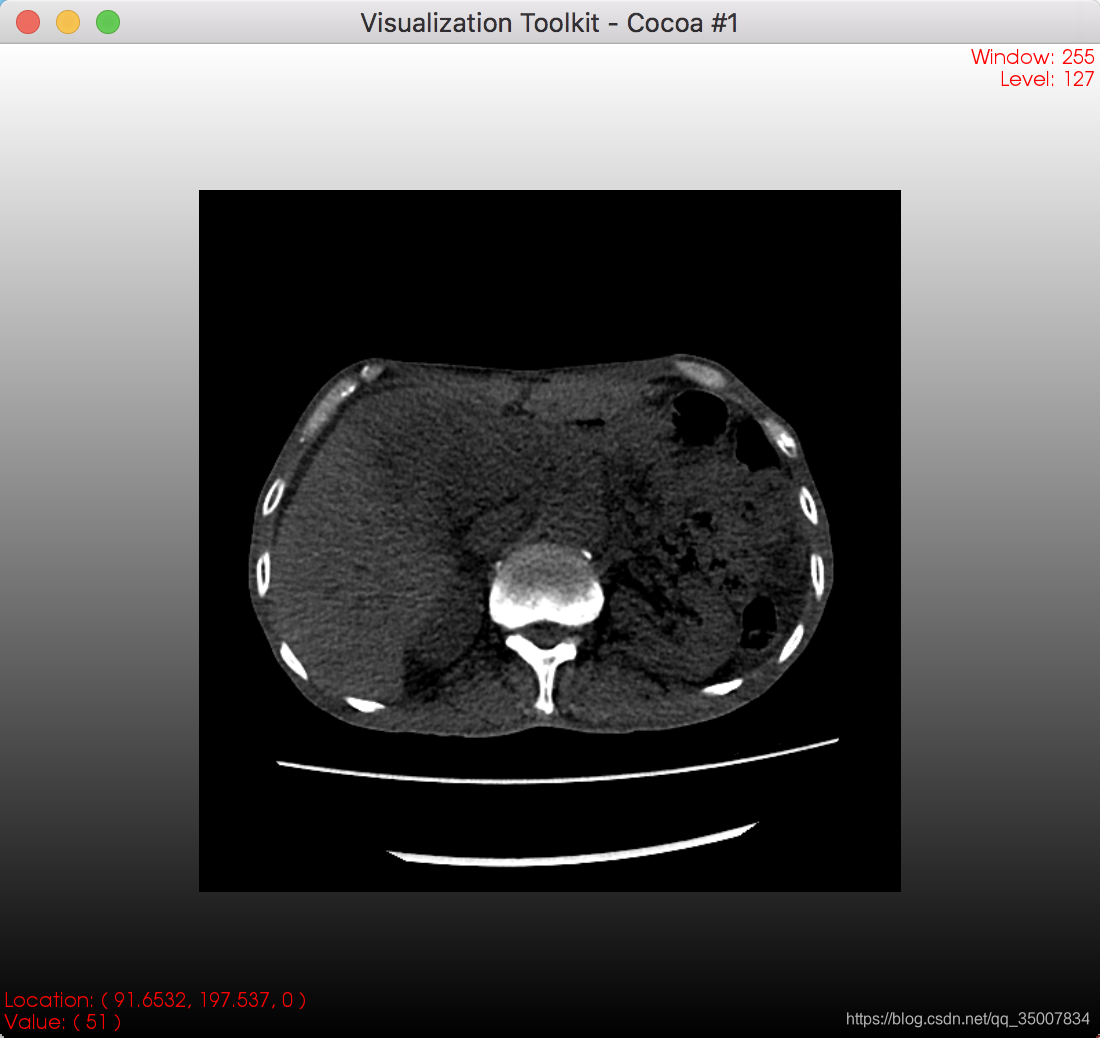 Vtk Ct VTK 鼠标交互实时显示窗口内图像的像素坐标(二维图像)_vtk中显示点坐标-CSDN博客