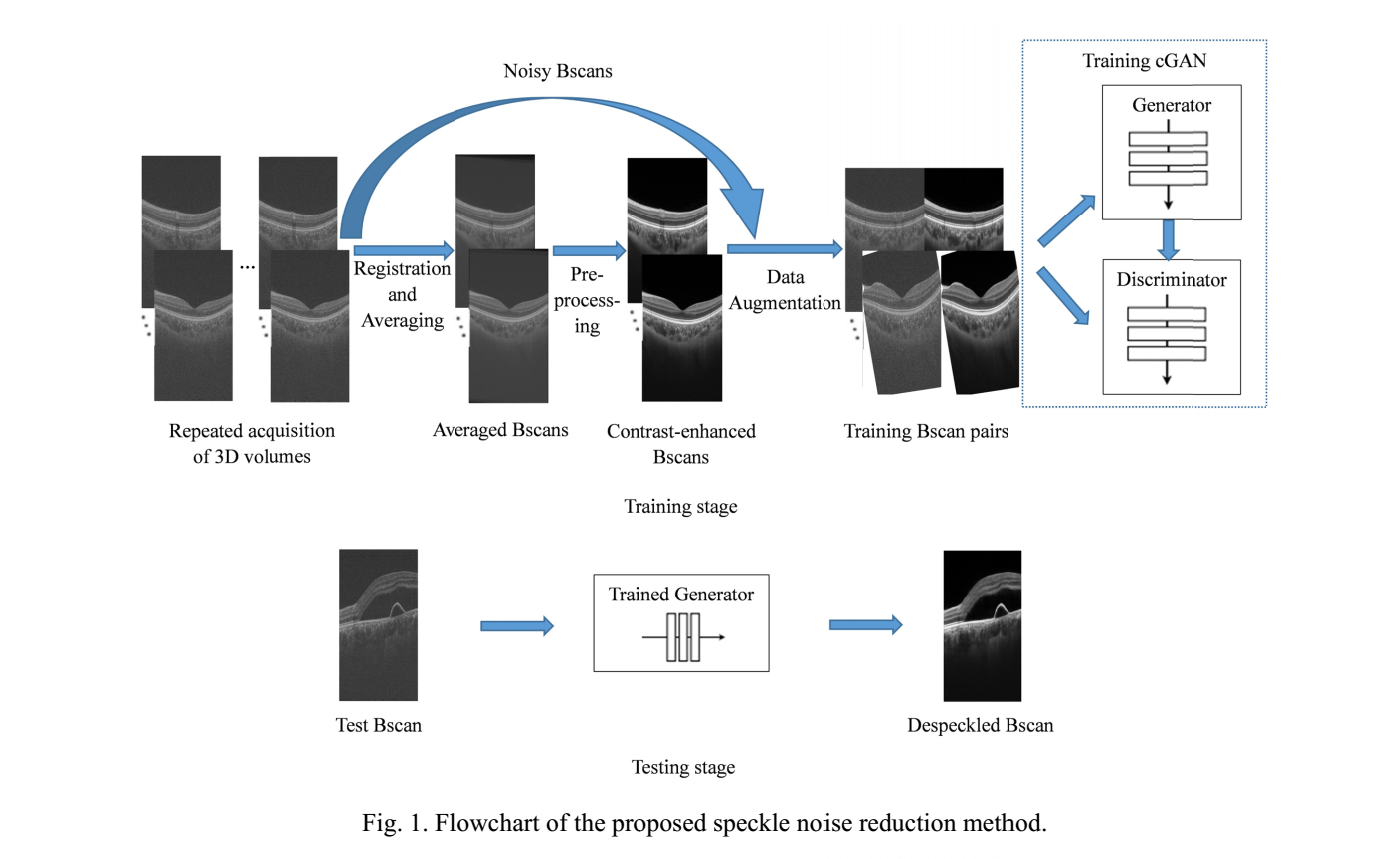《Speckle noise reduction in optical coherence tomography images based ...