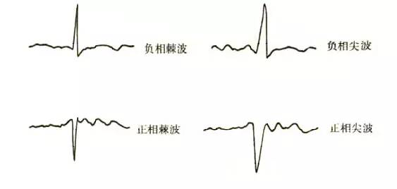 正相:当 g1 的电位相对于 g2 为正相时,引出向下的波形