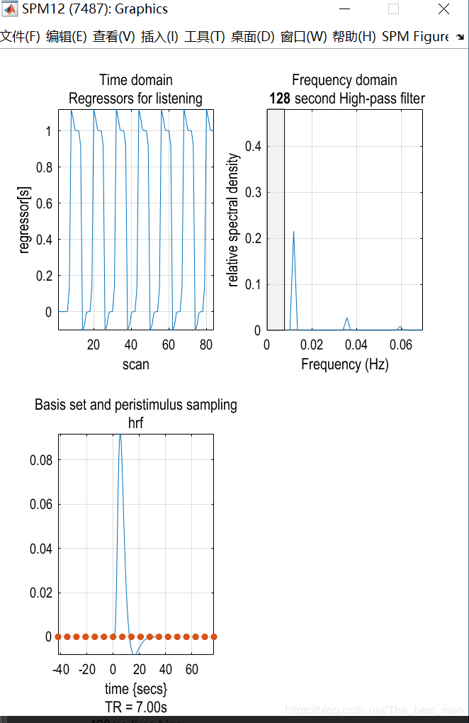 Matlab Spm Model SPM12入门案例1_matlab的spm中check reg-CSDN博客