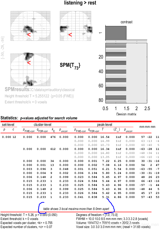 Matlab Spm Model SPM12入门案例1_matlab的spm中check reg-CSDN博客
