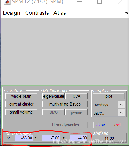 Matlab Spm Model SPM12入门案例1_matlab的spm中check reg-CSDN博客