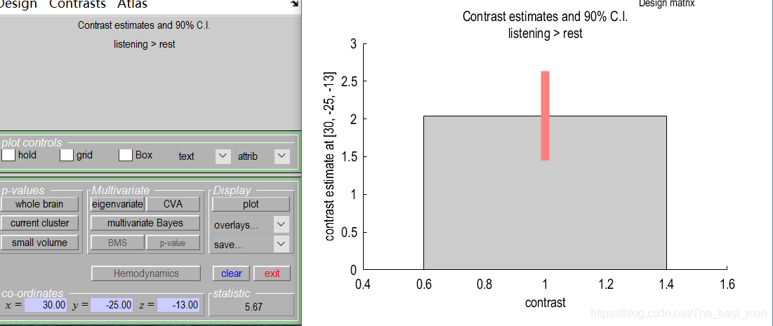 Matlab Spm Model SPM12入门案例1_matlab的spm中check reg-CSDN博客