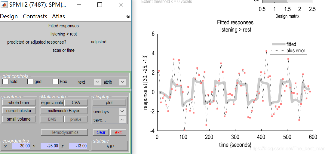 Matlab Spm Model SPM12入门案例1_matlab的spm中check reg-CSDN博客