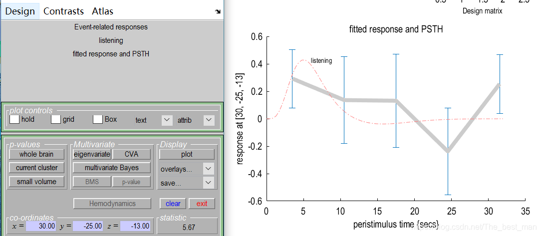 Matlab Spm Model SPM12入门案例1_matlab的spm中check reg-CSDN博客
