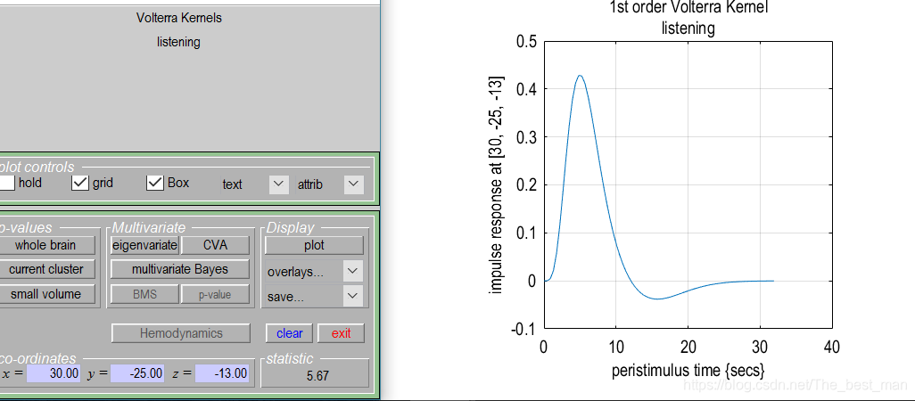 Matlab Spm Model SPM12入门案例1_matlab的spm中check reg-CSDN博客