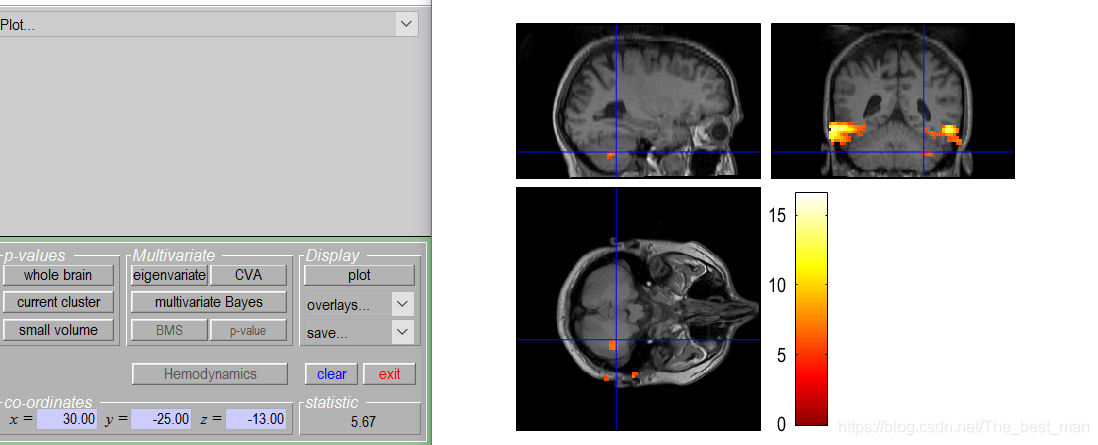 Matlab Spm Model SPM12入门案例1_matlab的spm中check reg-CSDN博客