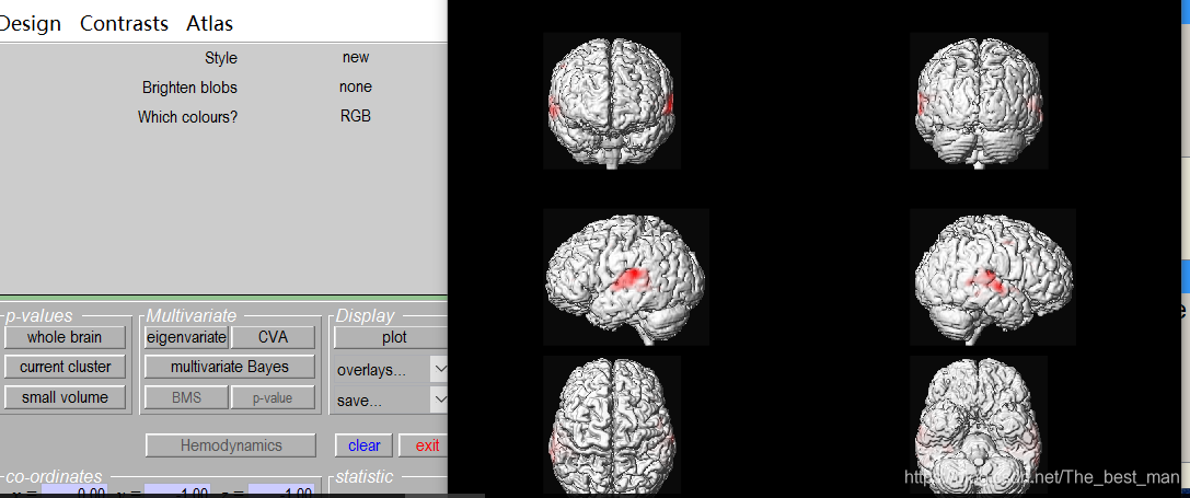 Matlab Spm Model SPM12入门案例1_matlab的spm中check reg-CSDN博客