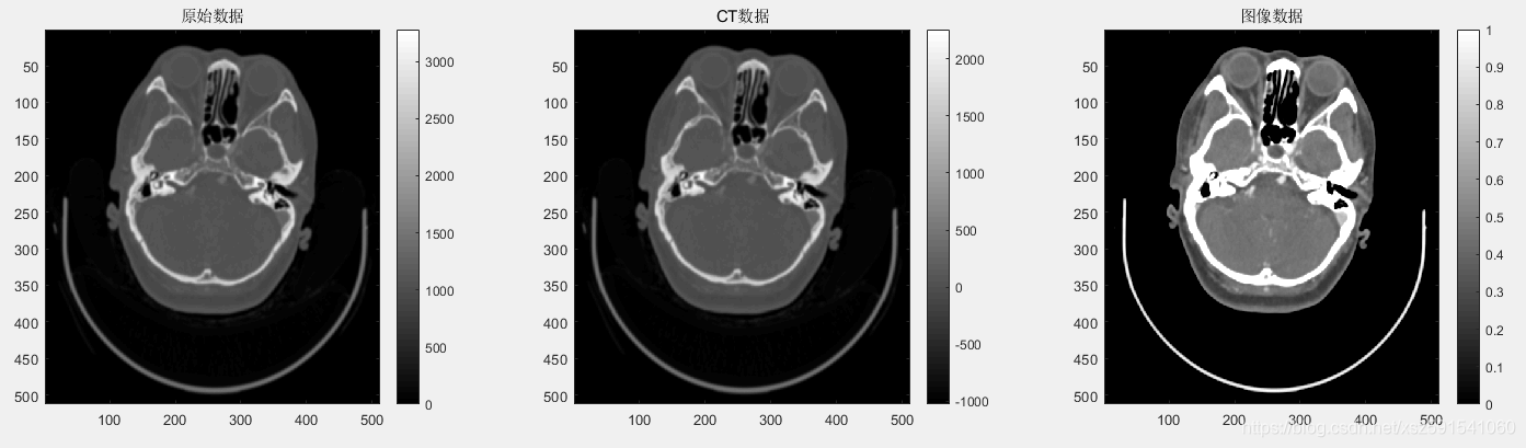 颅腔CT