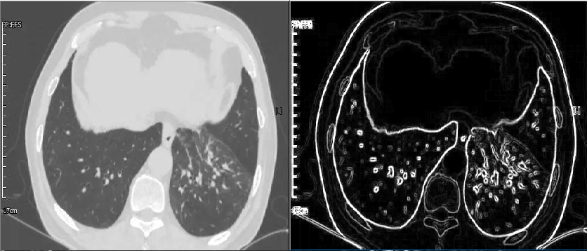 Prewitt算子边缘检测原理及实现