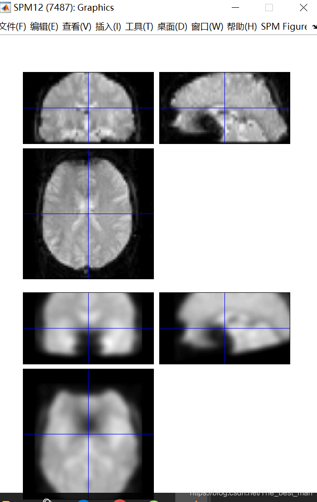 上面是functional image下面是8mm-smoothed functional image