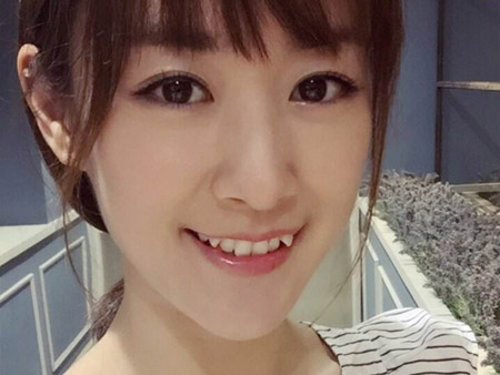 正畸的时候医生为什么不建议拔除虎牙?