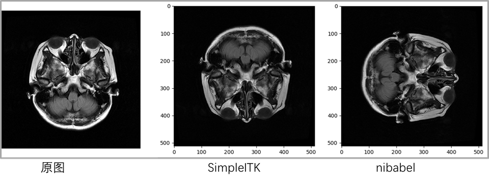 ​	   [外链图片转存失败(img-thMjD0nm-1563698300986)(C:\Users\eveadam\AppData\Roaming\Typora\typora-user-images\1563617733970.png)]