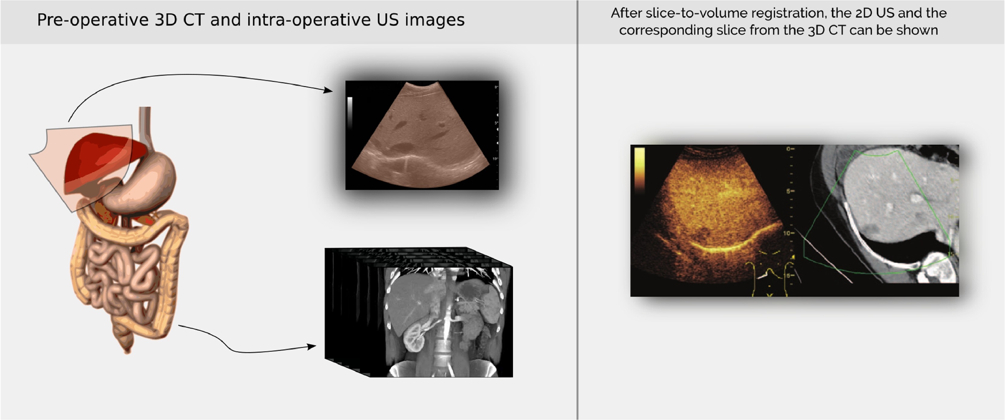 Imagej 平均荧光强度检测批量 Csdn