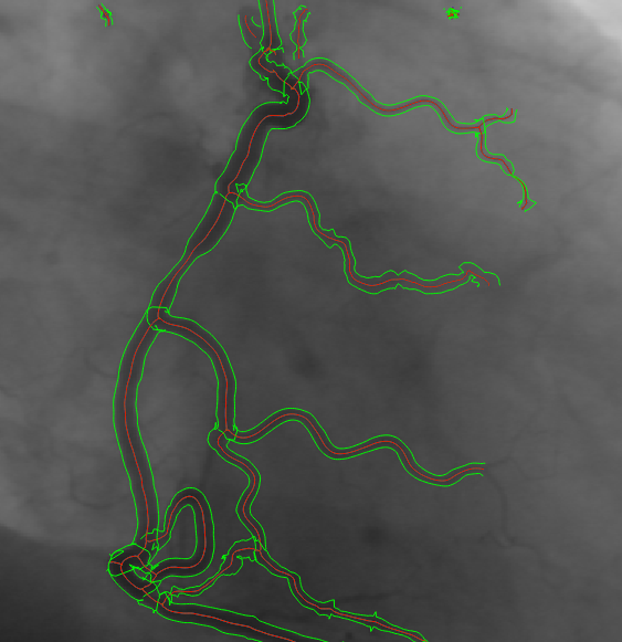 halcon line_gauss 线状物提取 (by shany shang)