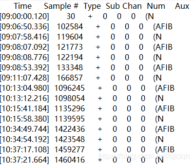 MIT-BIH Atrial Fibrillation Database(afdb)房颤数据库的介绍以及读取