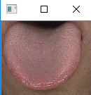 windows10平台下使用opencv识别舌苔